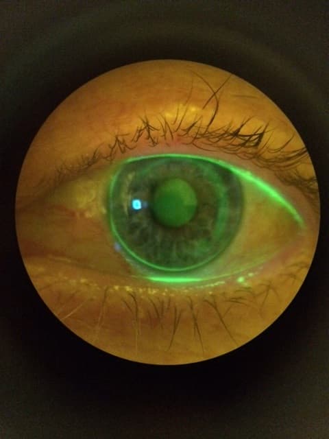 Optometrie
